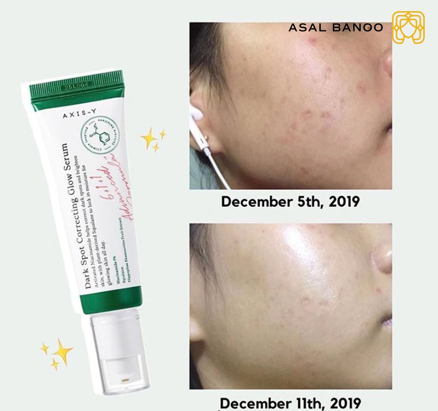 سرم ضد لک و روشن کننده اکسیس وای Axis-Y Dark Spot Correcting Glow Serum
